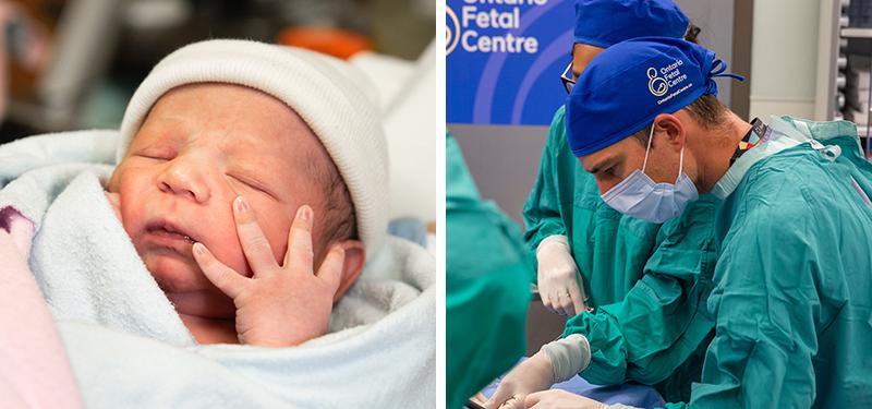 collage of a newborn in left panel and a surgical team working in right panel