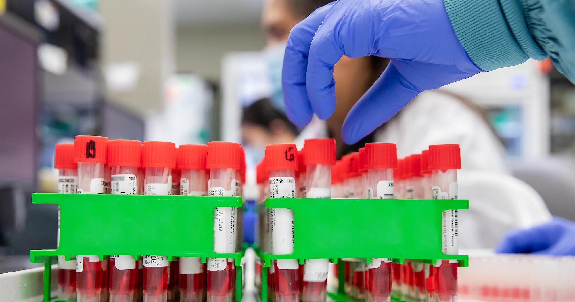 Gloved hand reaching over vials of blood in a lab.