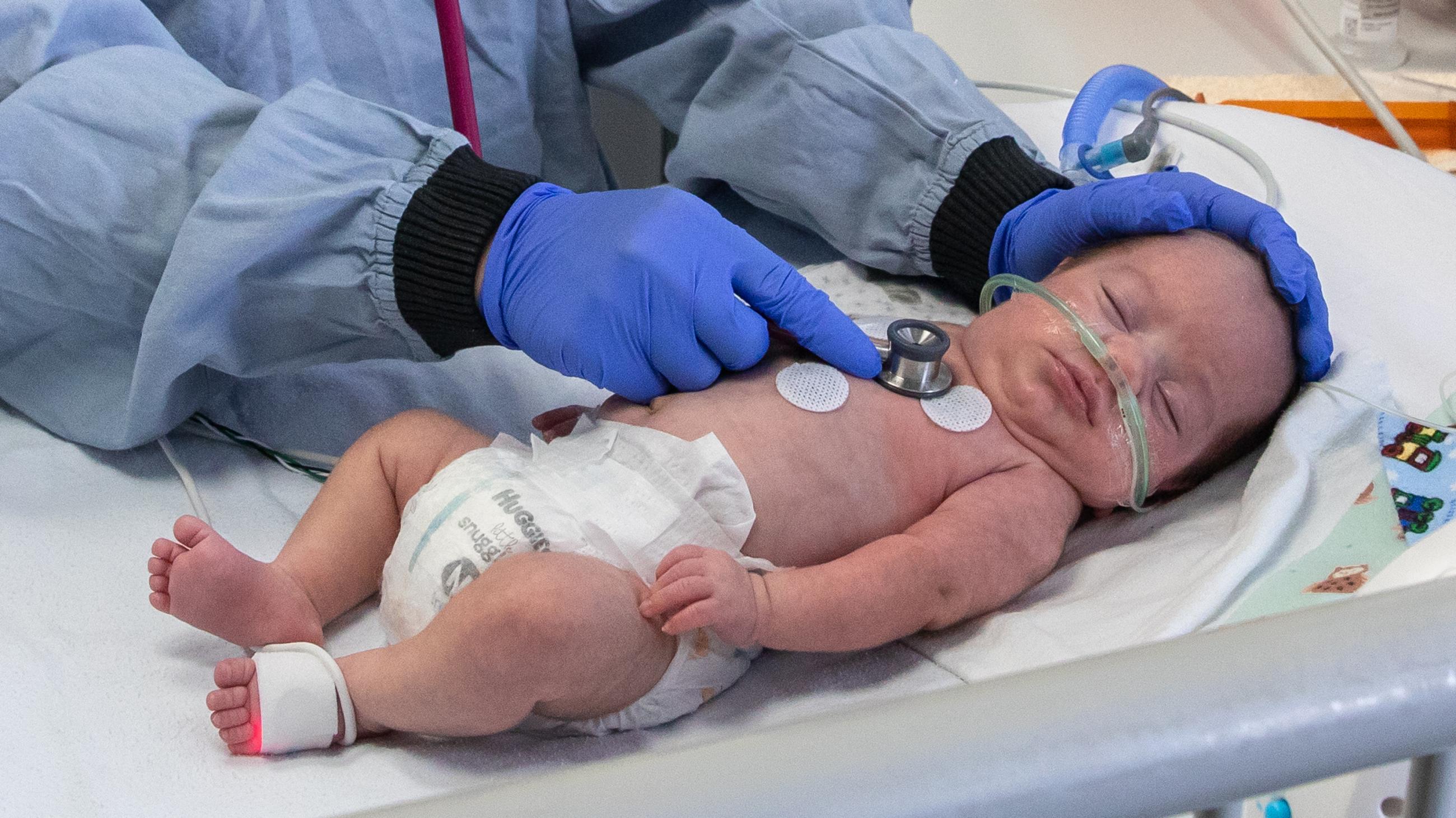 Nurse examining preterm baby with a stethoscope.