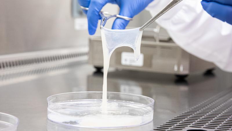 Placental tissue held up to be examined