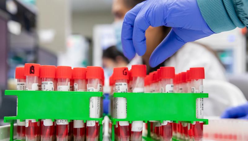 Gloved hand reaching over vials of blood in a lab.