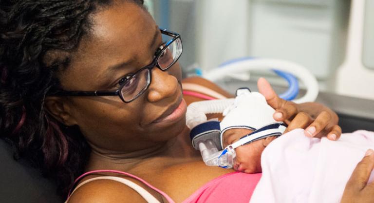 Donated Breast Milk reduces risk of life threatening condition in Preterm Infants