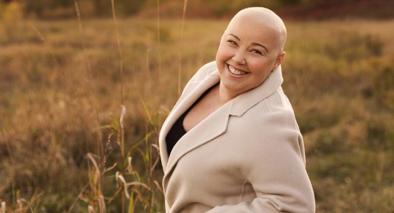 woman with no hair smiling